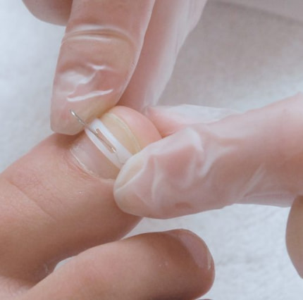 beautylounge-fusspflege-podofix